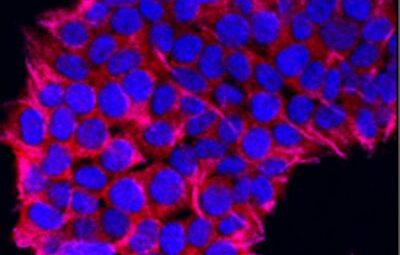 DNA Testi nerede nasıl yapılır